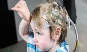 علائم بیماری صرع چیست و چگونه تشخیص داده می‌شود؟