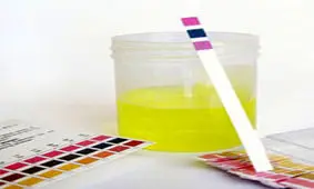 دلایل بوی بد ادرار