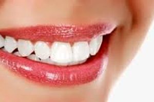 راز دندان های مرواریدی با نسخه های خانگی