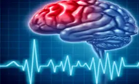 روزانه حدود 150 نفر در تهران سکته مغزی می کنند