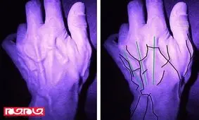 عکس رگ دست مجرمان به زودی آنها را لو می دهد