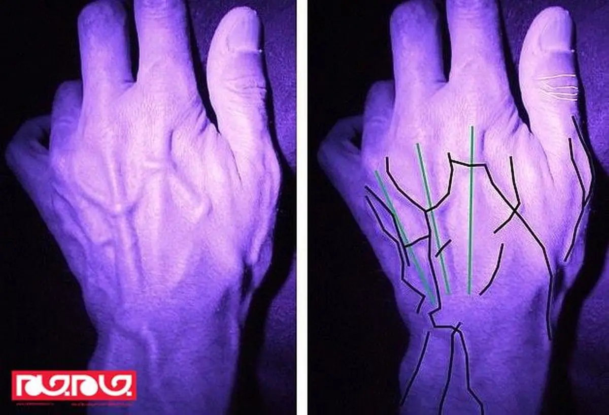 عکس رگ دست مجرمان به زودی آنها را لو می دهد