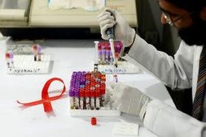 واکسن HIV نداریم؛ فریب نخورید