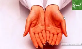 از علت تا درمان تعریق کف دست و پا