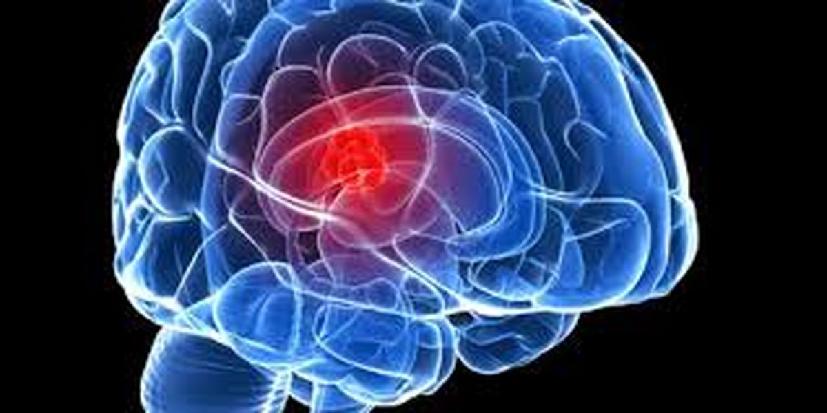 تومور مغزی چه علائمی دارد؟