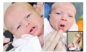 تولد این نوزاد عجیب باعث شگفتی همه شد+عکس