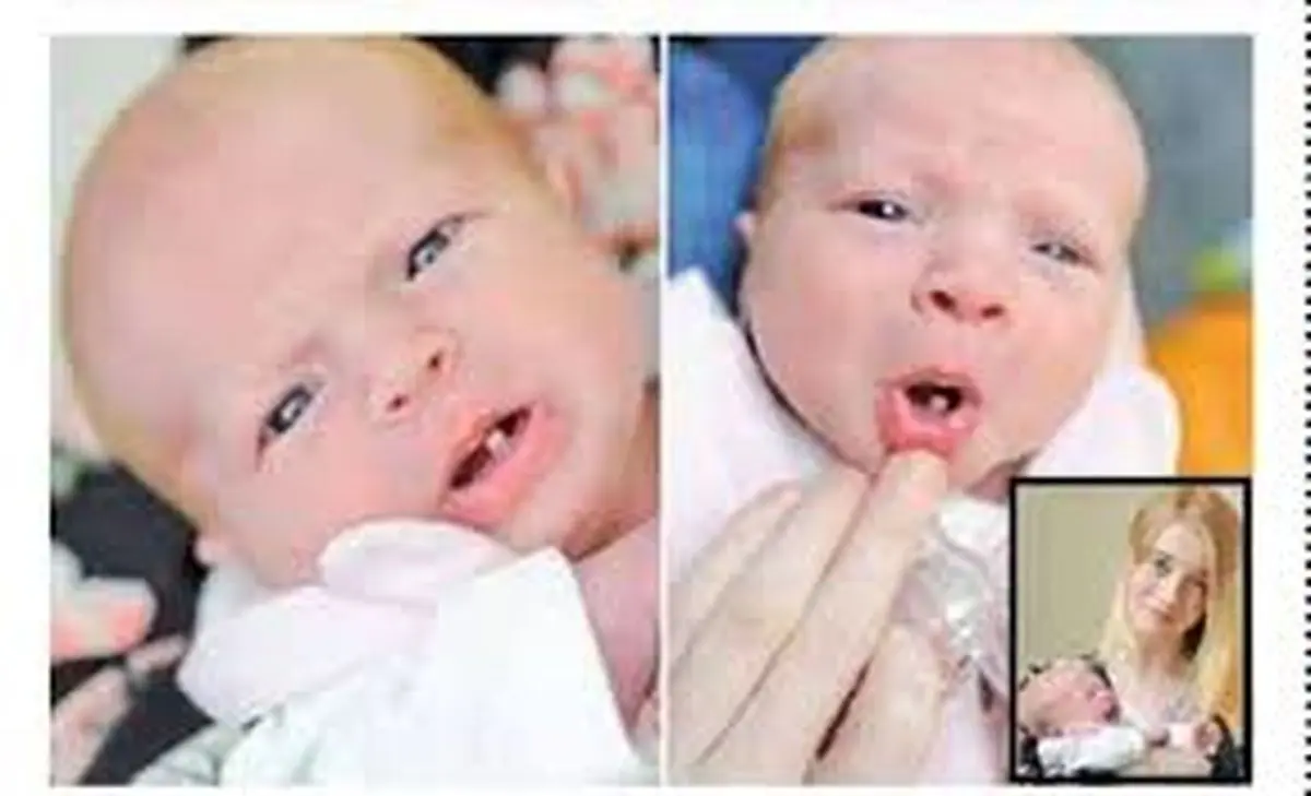 تولد این نوزاد عجیب باعث شگفتی همه شد+عکس