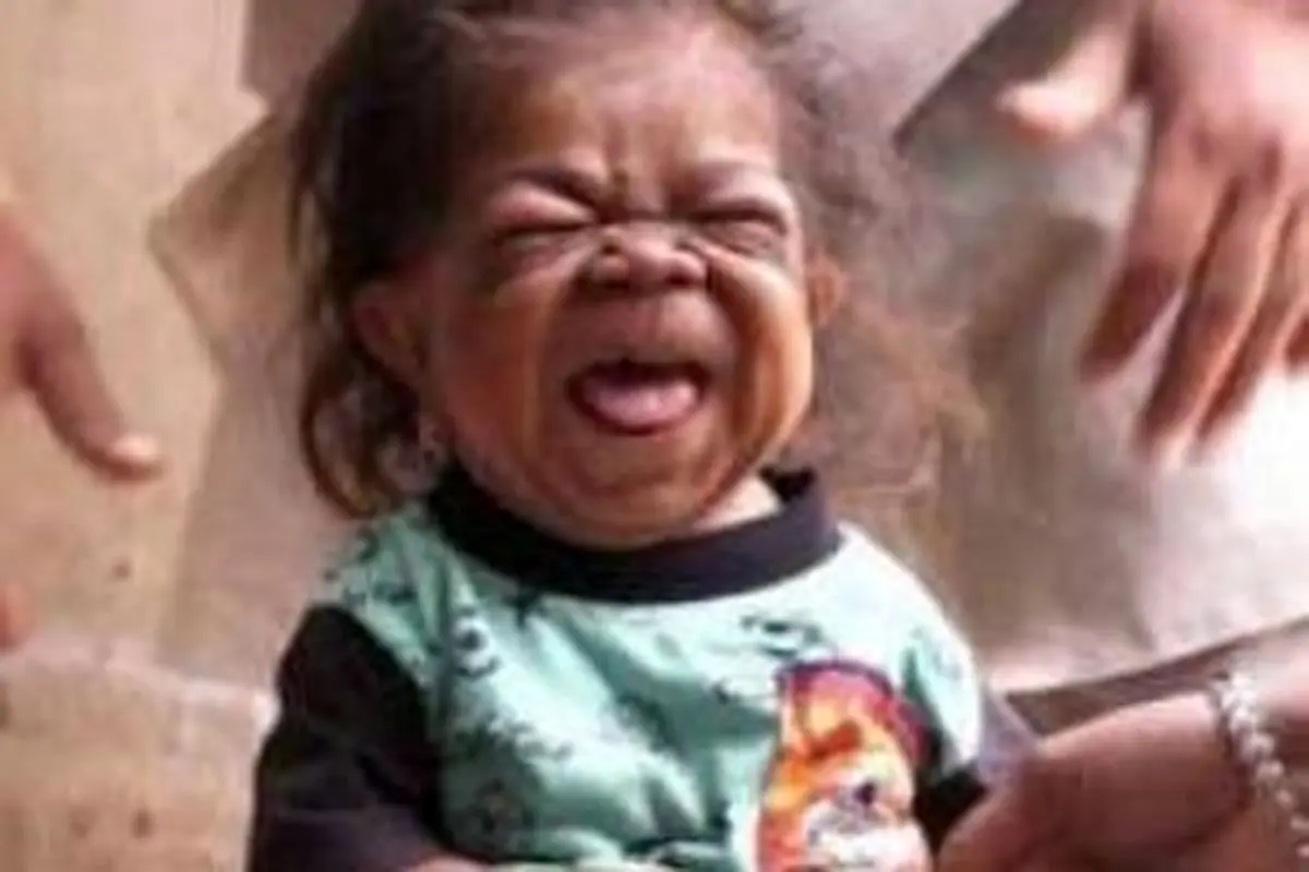 مردی هندی با قد و قواره نوزاد چند ماهه (عکس)