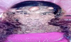 این دختر جوان با بدن عجیبش همه را شوکه کرد (عکس 18+)