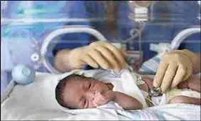 زایمان زودهنگام در کمین زنانی که کیسه صفرا ندارند