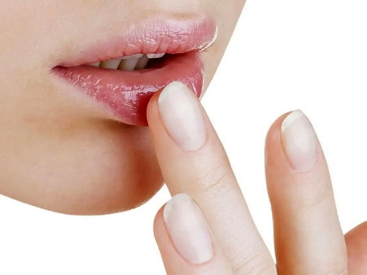 علل پوسته پوسته شدن و خشکی لب در بارداری + روش درمان