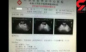 راز عجیب مرد 40 ساله و دختر 12 ساله خارجی در سونوگرافی لو رفت+عکس