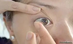 فاجعه ای به نام لنزهای زیبایی