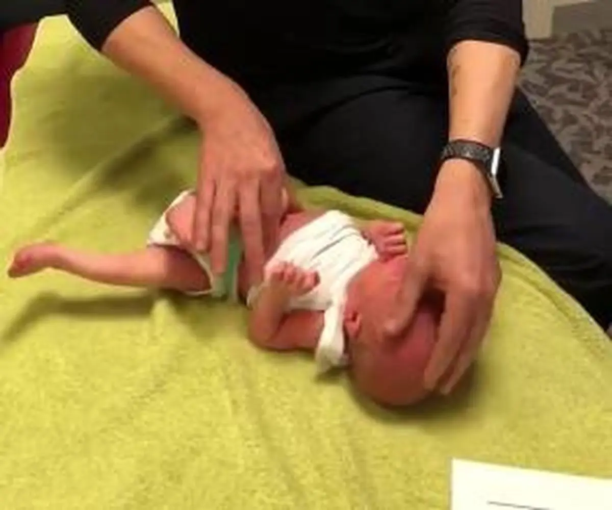 رفتار جنجالی فیزیوتراپ با نوزاد 2 هفته ای + تصاویر