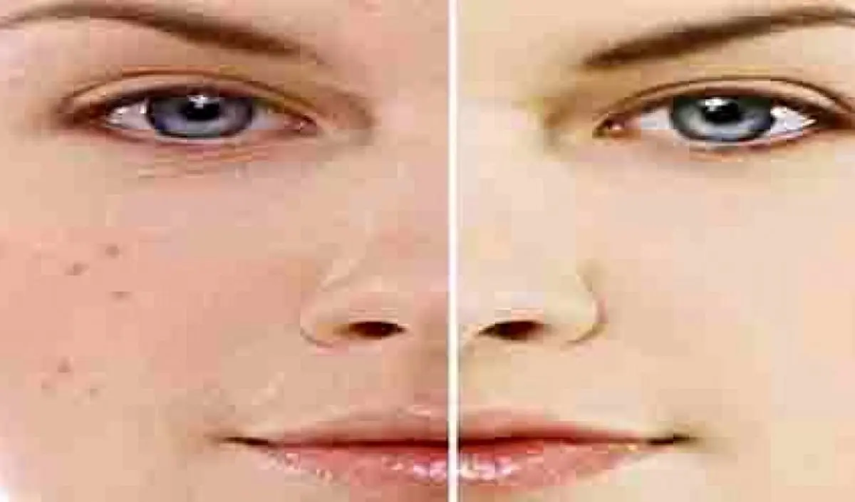 گیاهی معجزه‌گر که پوستتان را جوان و شاداب می‌کند