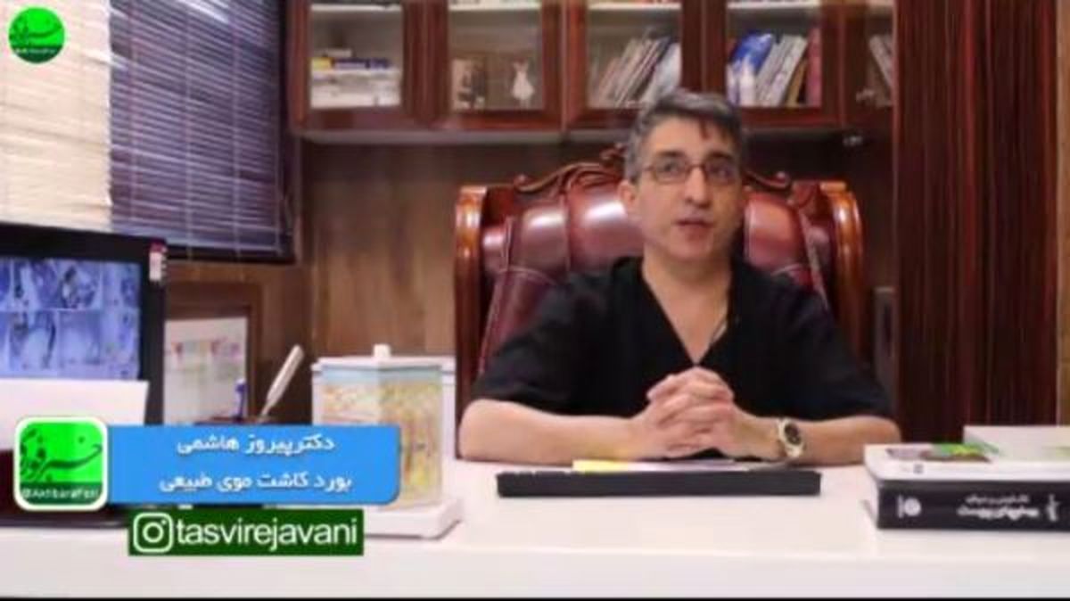 یکی از عوارض غیرقابل جبران در کاشت مو، تخریب بانک مو است/ اشتباه رایج در بین افراد متقاضی کاشت مو