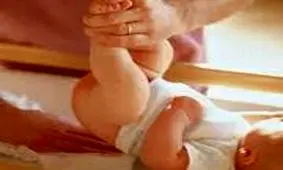 درمان سوختگی پای بچه از ادرار