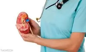 درمان سنگ کلیه با نسخه مادربزرگ ها