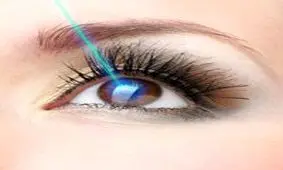 10 نکته طلایی قبل از عمل‌های لیزری
