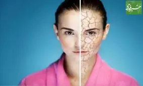 اندازه گیری آب بدن با یک دستگاه نوین