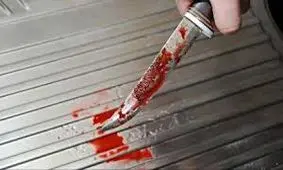 مردی با چاقویی در بدن به دنبال سیگار!