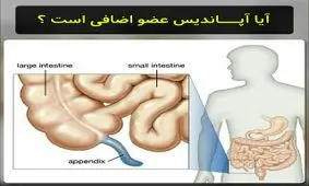 آیا اپاندیس عضو اضافه ای است ؟