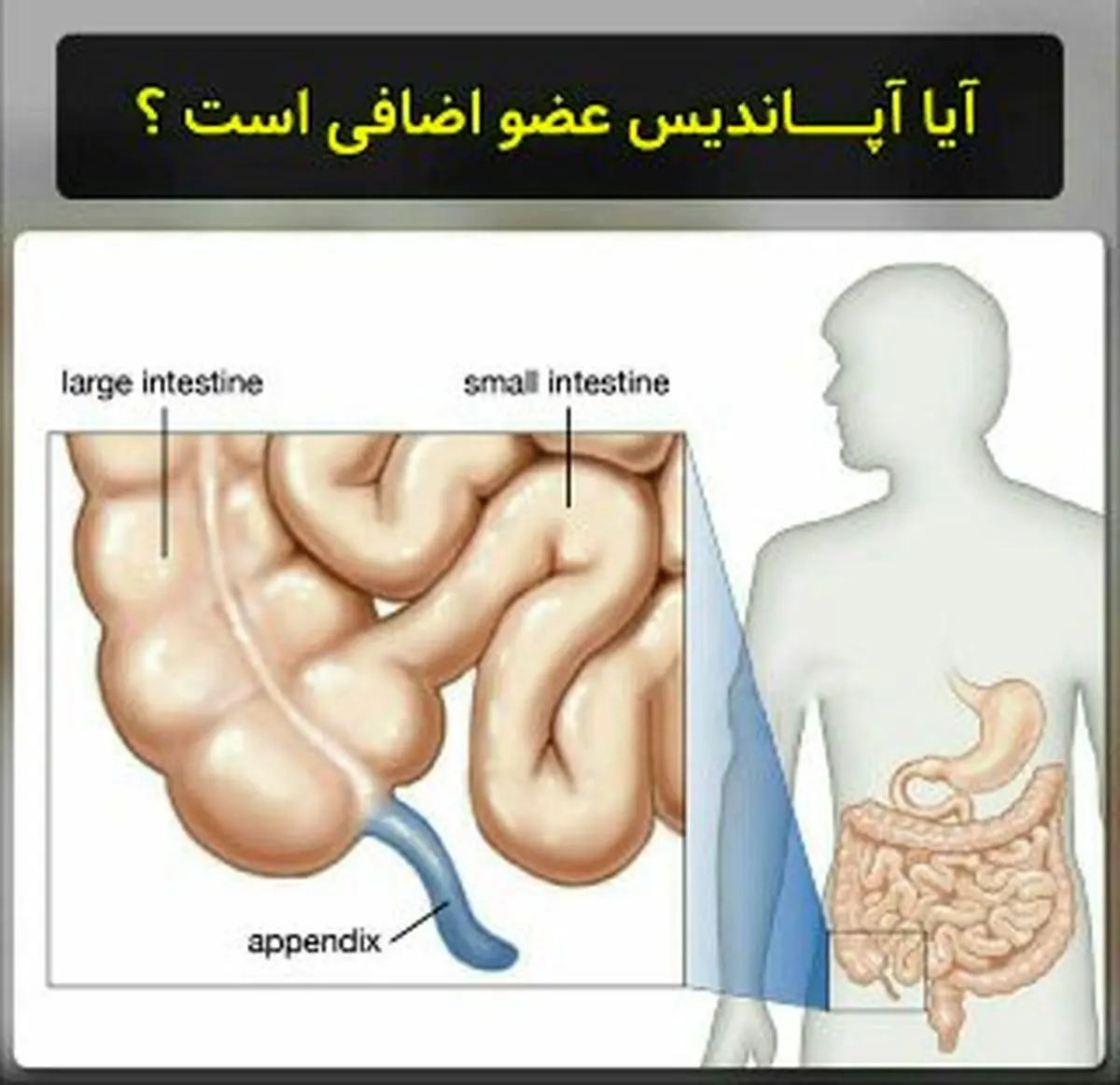 آیا اپاندیس عضو اضافه ای است ؟