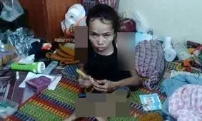 ازدواج دختر معلولی که همه را شگفت زده کرد+ تصاویر