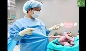 بازیگوشی نوزاد تازه متولد شده با خانم دکتر+ عکس