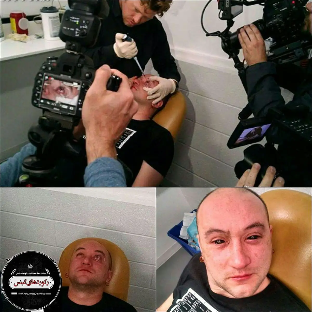 ابداع قطره چشمی که دید در شب را ممکن می‌کند