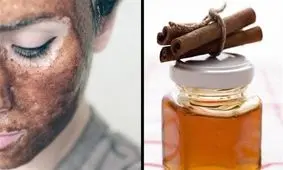 ماسک آخر سالی عسل و دارچین