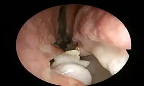 مردی که دماغش دندان درآورد! + عکس