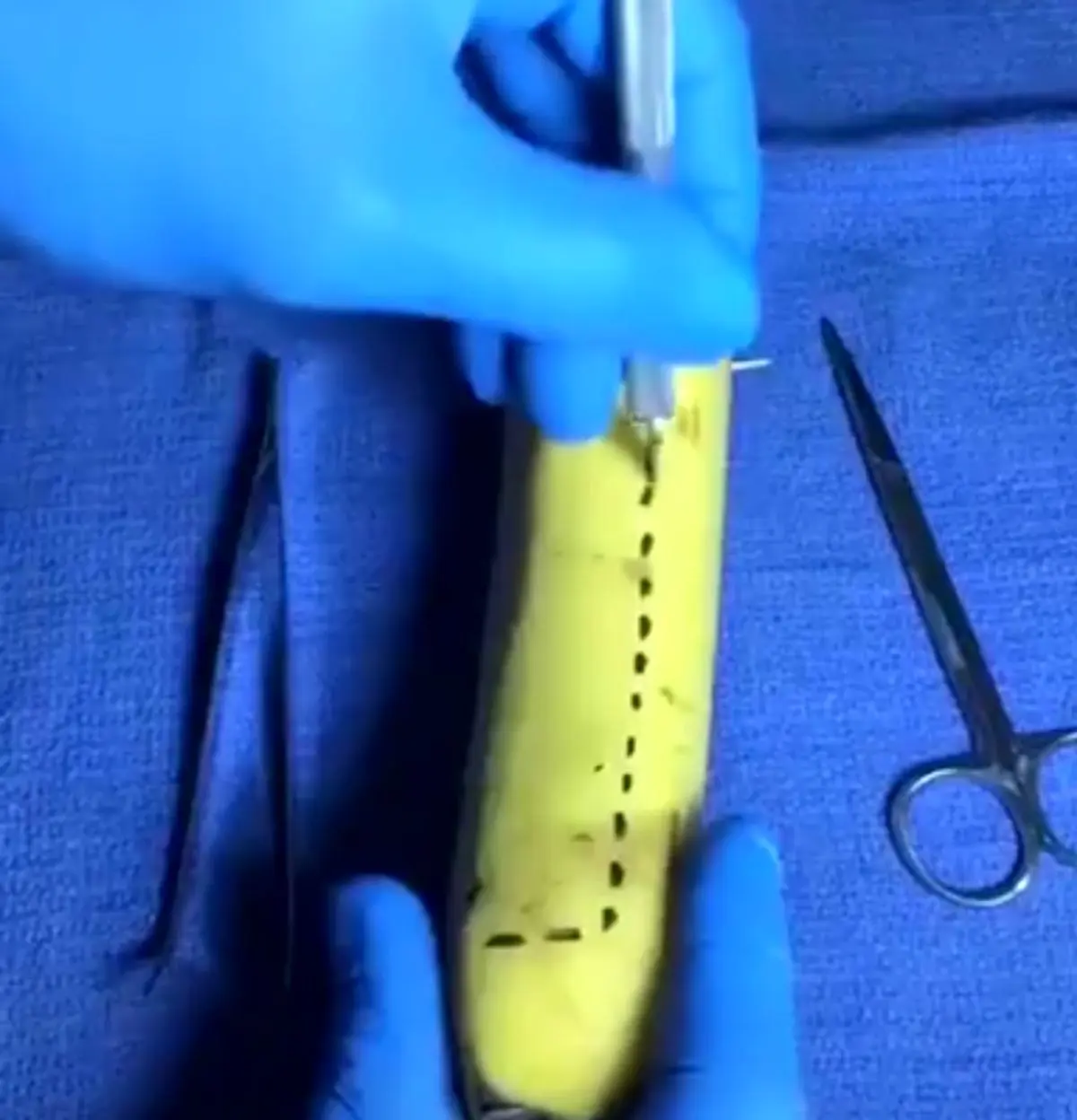 زایمان موز دیده بودید