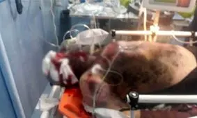 انفجار مواد محترقه در منزل مسکونی