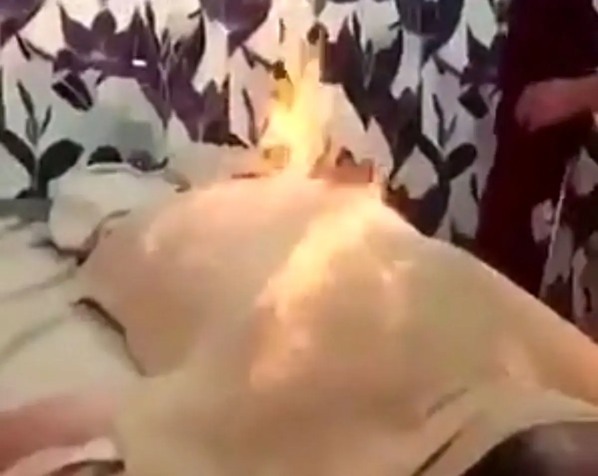 ماساژ با آتش