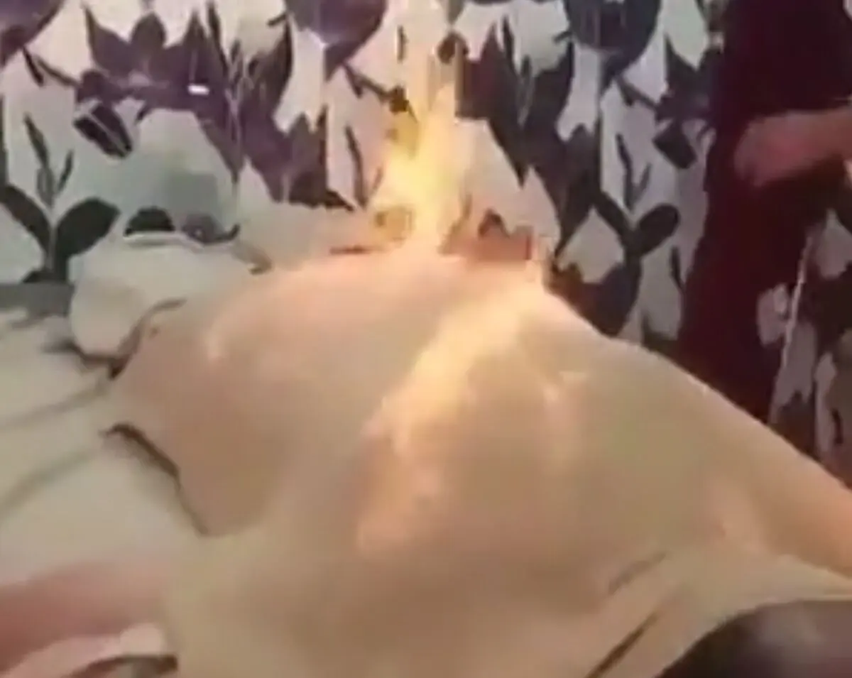 ماساژ با آتش