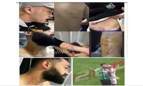 اتفاقی عجیب در لیگ دسته سوم ترکیه