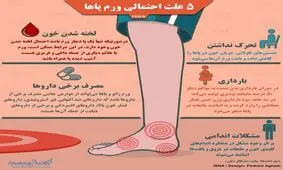 پنج علت احتمالی ورم پاها