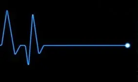 فرآیند فیزیکی مرگ چگونه است؟