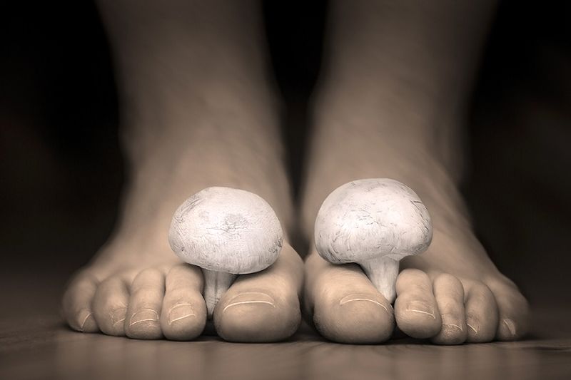 قارچ ناخنها؛ از علائم و علل تا درمانهای پزشکی و خانگی
