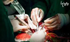 اشتباهات فاجعه‌بار در عمل‌های جراحی