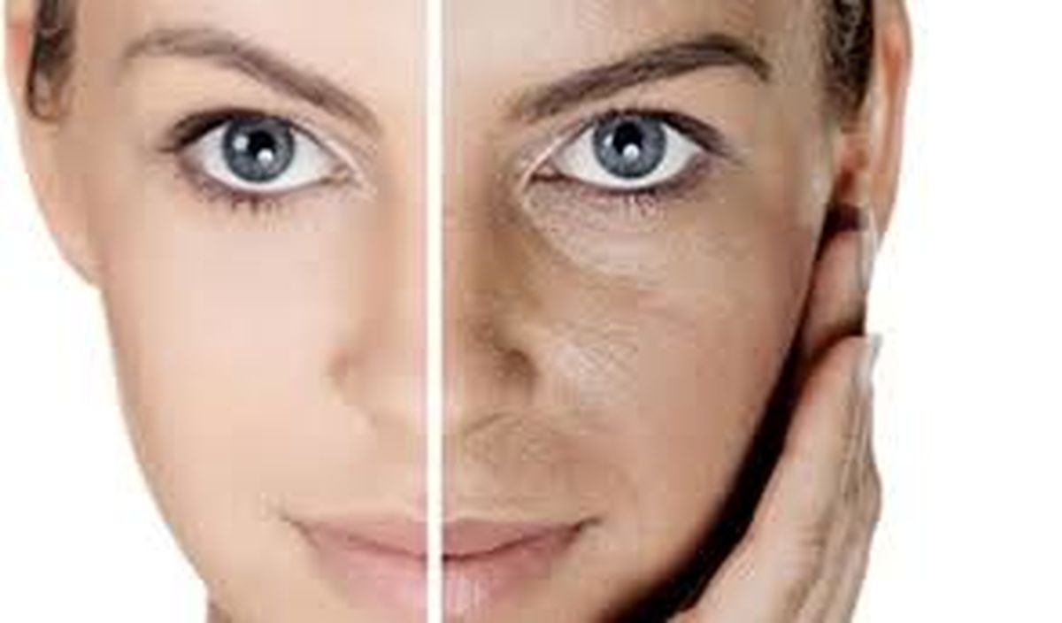 تغییر رنگ پوست خبر از چه بیماری می دهد؟