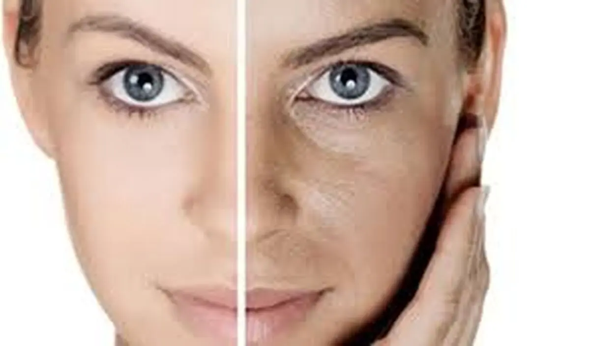 تغییر رنگ پوست خبر از چه بیماری می دهد؟