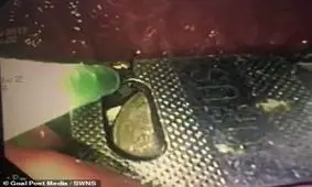 مرد هندی عاشق قورت دادن سیمکارت و کلید ! + عکس جنجالی