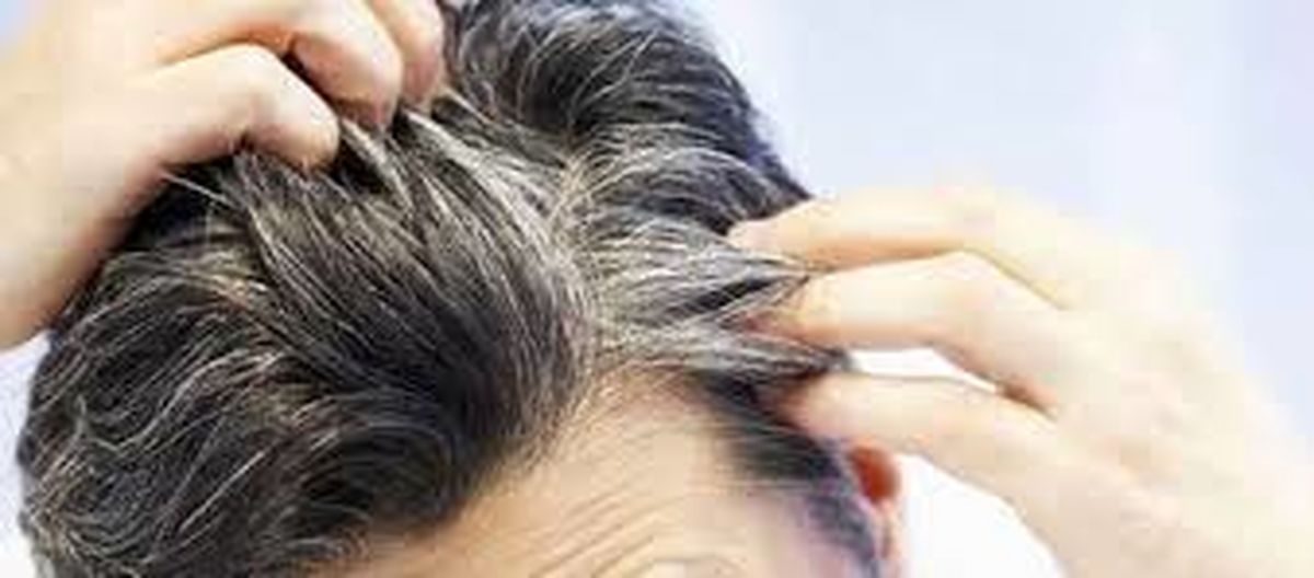 کدام مواد غذایی جلوی سفید شدن موی شما را میگیرد؟
