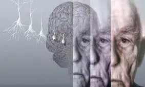 مطالعه مستمر و دوری از استرس مانع ابتلا به "آلزایمر" می‌شود