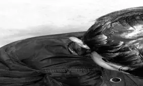 حمله سگ ولگرد به پسر نوجوان در شهر سهند