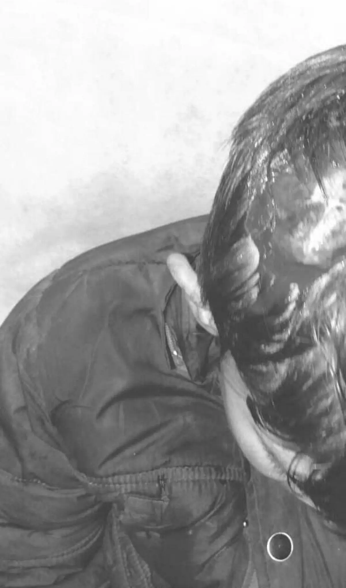 حمله سگ ولگرد به پسر نوجوان در شهر سهند
