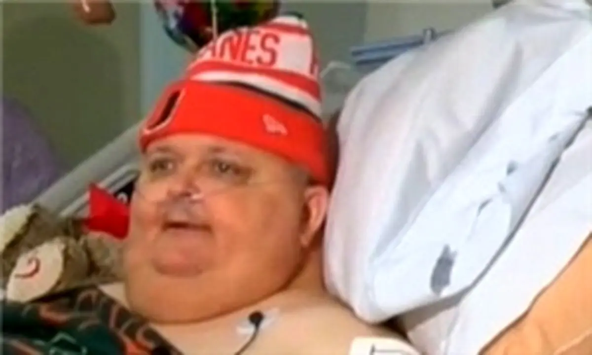 خارج کردن تومور 62 کیلویی از شکم مرد 57 ساله