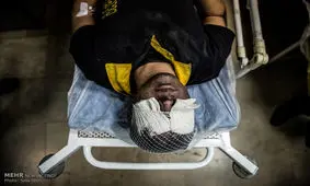 نخستین مصدوم چهارشنبه سوری لرستان در دورود